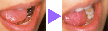 �m�����^��before��after