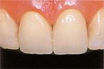 �O����after