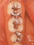 �P����before