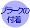 プラークの付着