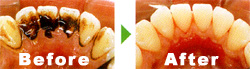 �O�������Fbefore��after