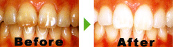 �O�������Fbefore��after