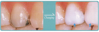 �����C�����̐F�����P��before��after